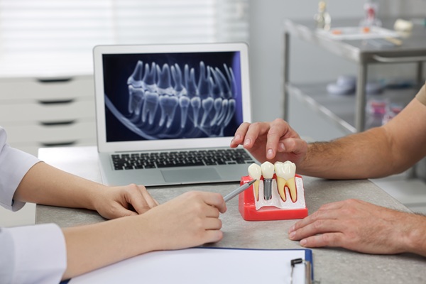 Complete Your Smile With An Implant Crown